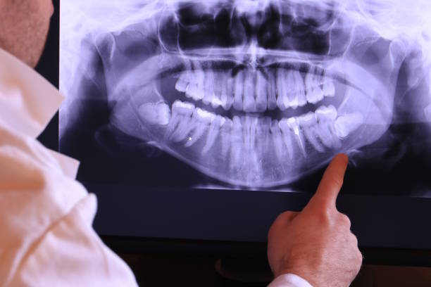 Best Urgent Care for Lost Fillings or Crowns in Brewer, ME